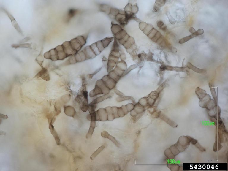 microscope view of alternaria spores