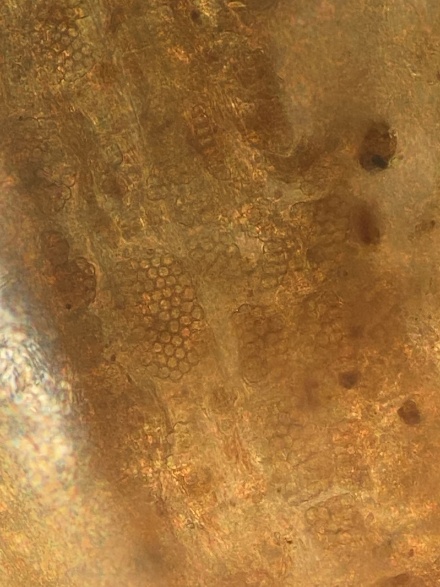 microscope image of disease spores